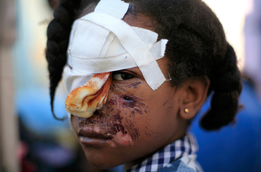 haitiwound haitiwound